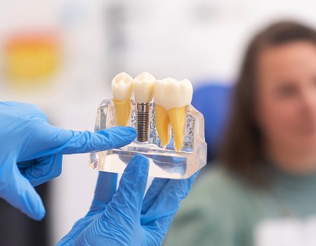 Dental Implant Treatment in Pune