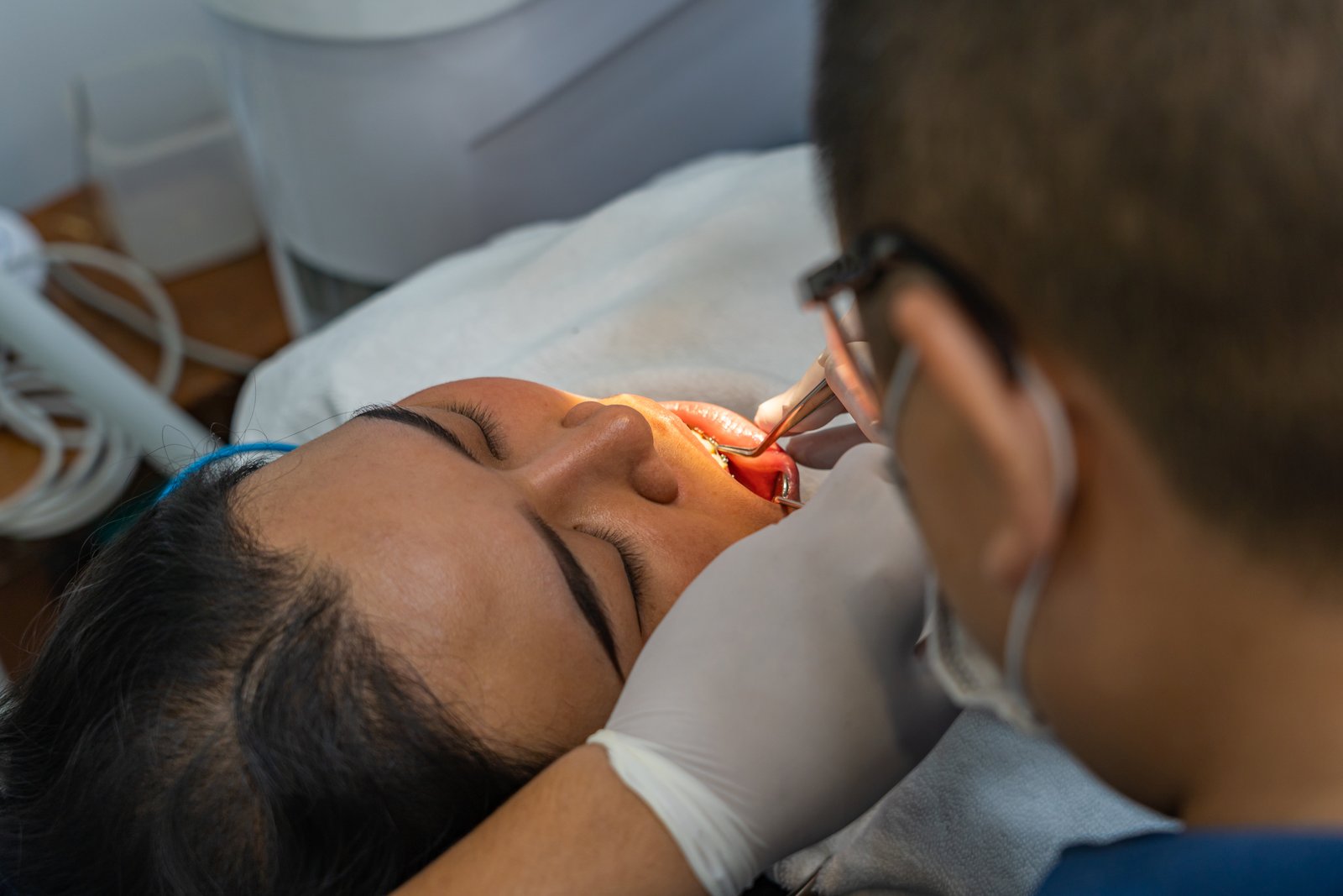 Full Mouth Rehabilitation Treatment in Pune
