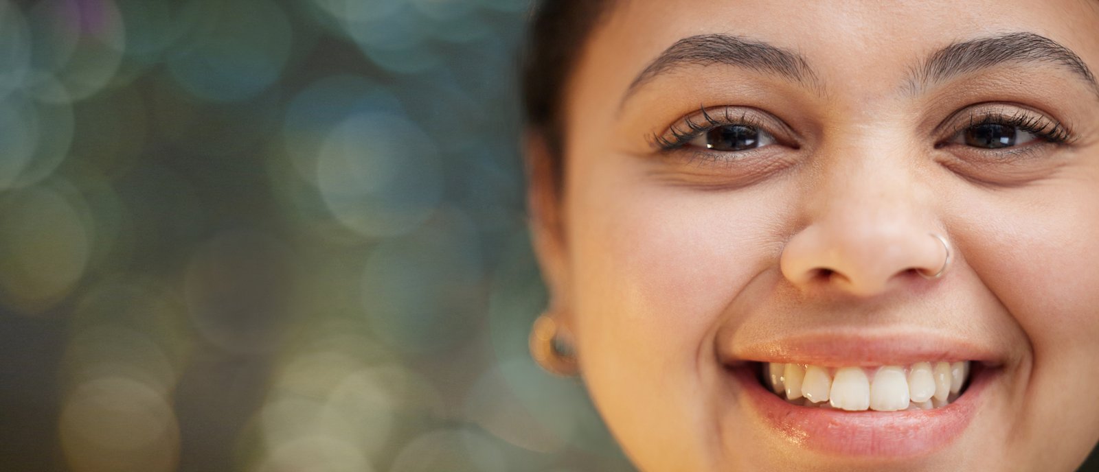 Before and After Smile Makeover Pune